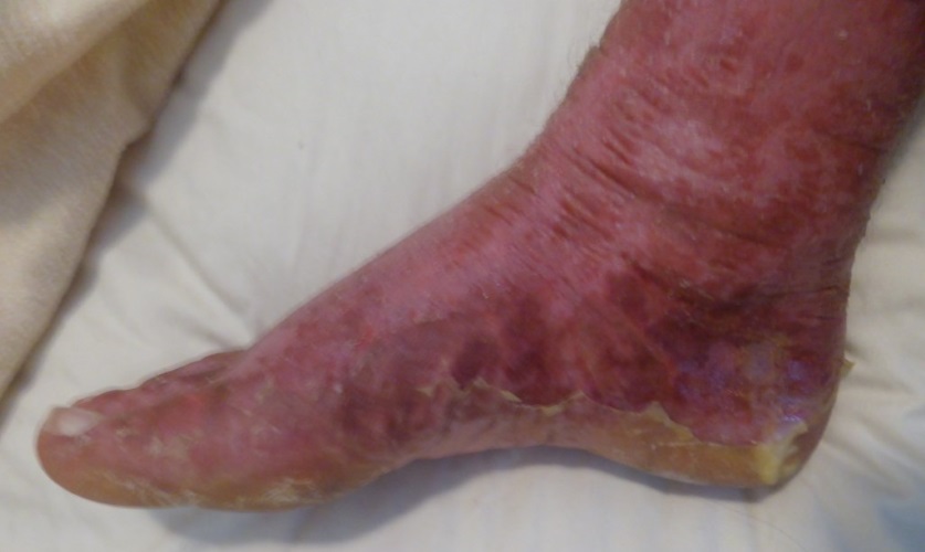 My foot